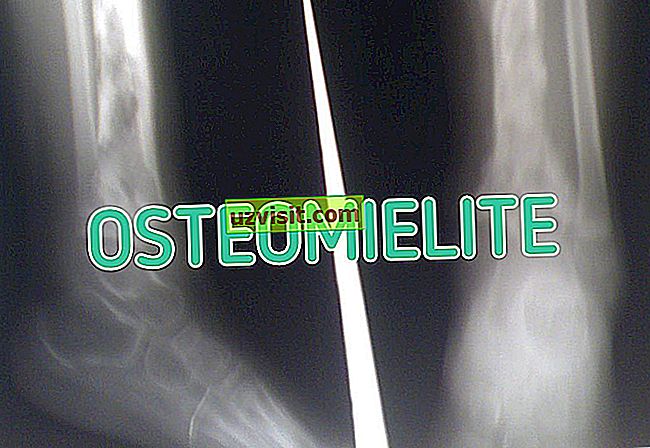 osteomielite - medicina