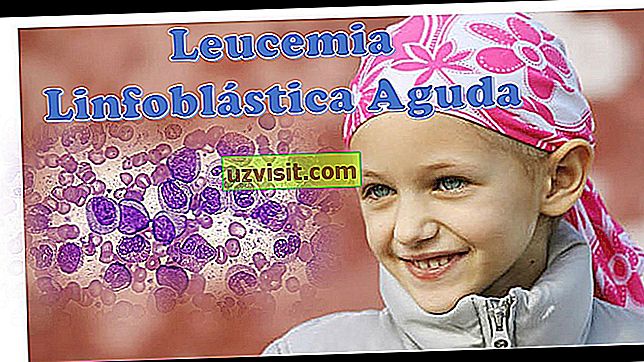 leucemia - medicina
